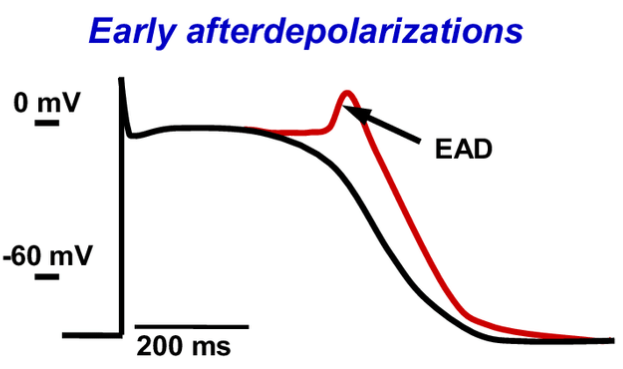 Early afterdepolarizations