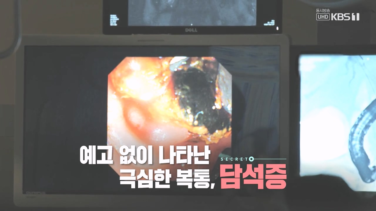 생로병사의 비밀.E886.231019p-NEXT.mp4_20231019_201506.974.jpg