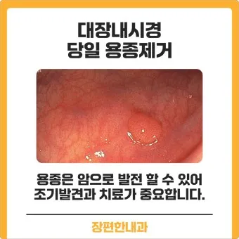 대장내시경 용종제거 후 식사 식단조절_21