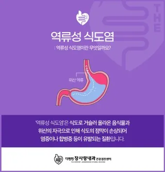 식도염에 좋은 음식 안좋은 음식_6