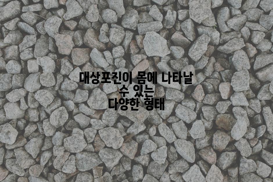 대상포진이 몸에 나타날 수 있는 다양한 형태