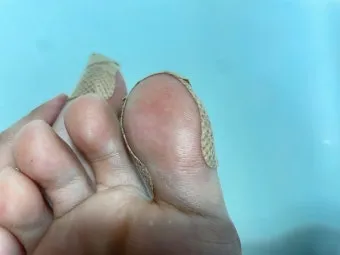 라셀턴 사용법과 가격 비교 발톱앰플 후기 정리해보기_15