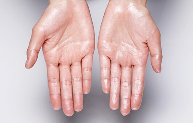 협심증의 초기 증상 7