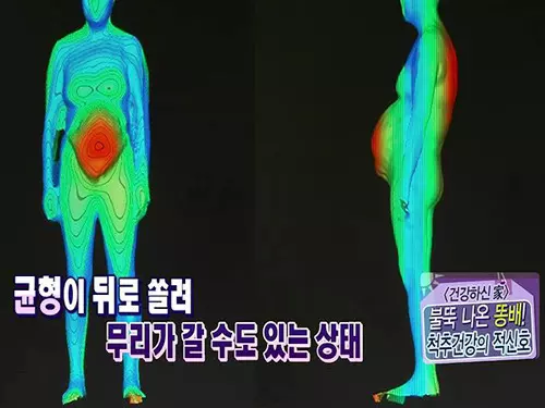 척추 교정 운동법 7가지