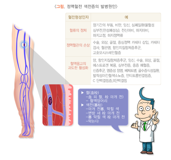 대장암에 의한 색전증이란? 특징, 원인, 증상, 치료 및 수술방법