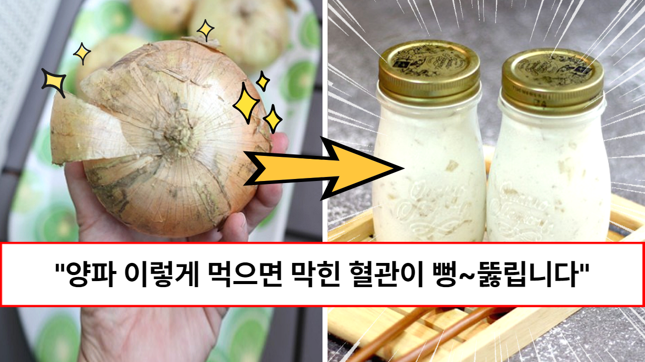 “맵지 않고 맛있습니다” 막힌 혈관을 청소하고 피를 깨끗하게 만들어 주는 양파 요구르트 & 유산균 양파 “맵지 않고 맛있습니다” 막힌 혈관을 청소하고 피를 깨끗하게 만들어 주는 양파 요구르트 & 유산균 양파