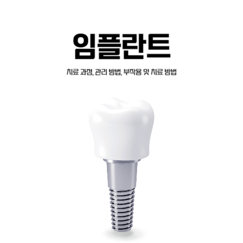  임플란트 치료 과정, 관리 방법, 부작용 및 치료 방법 5단계로 알아보기