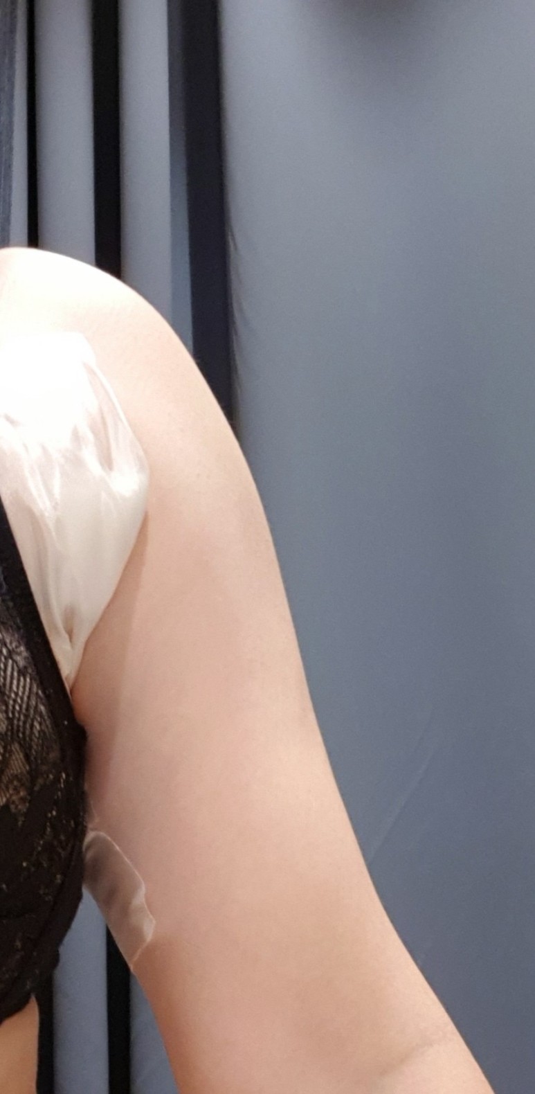 좋네요. 2회차 후기 지방분해주사 팔뚝살빼기 딱 4