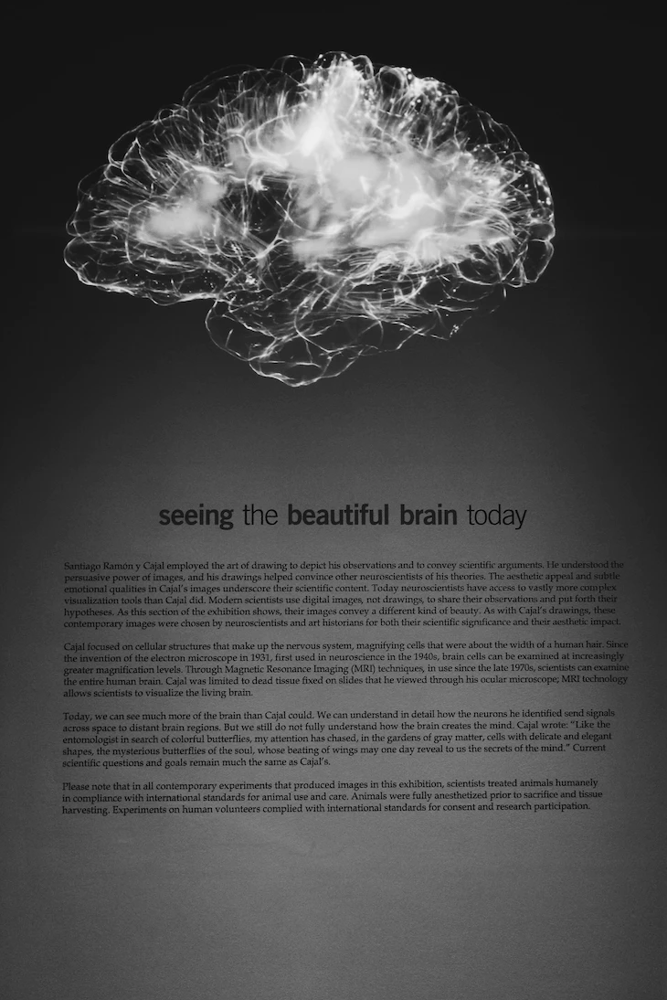 뇌mri