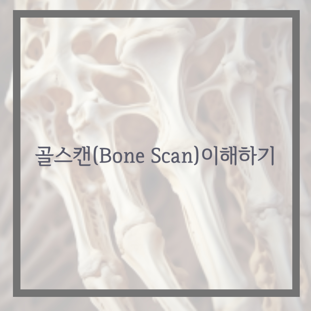 골스캔(Bone Scan)이란