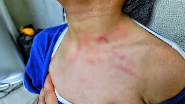  때리고 밀고…포항 '어린이집 학대' 신고하자 사과문