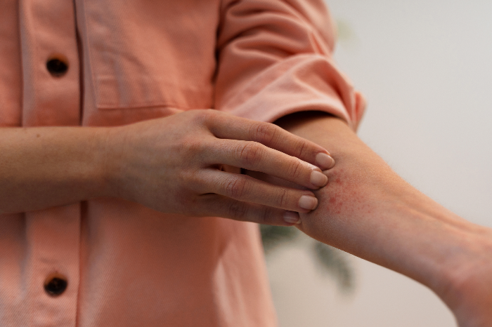 가려움증은 피부를 긁거나 문지르고 싶은 충동을 일으키는&#44; 불쾌하고 흔한 증상