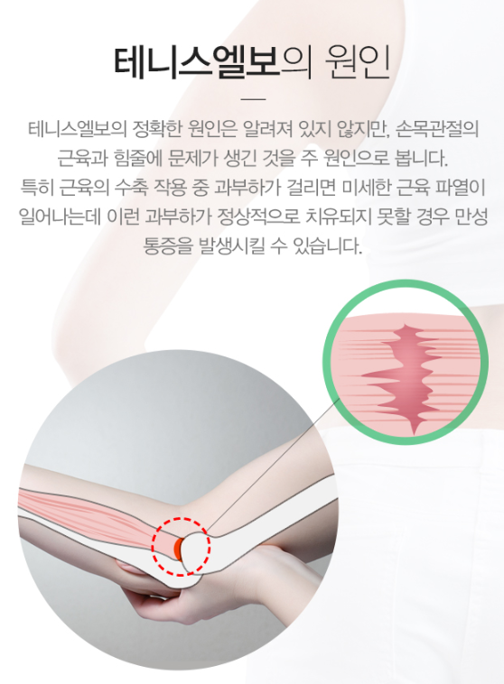 테니스엘보우 원인