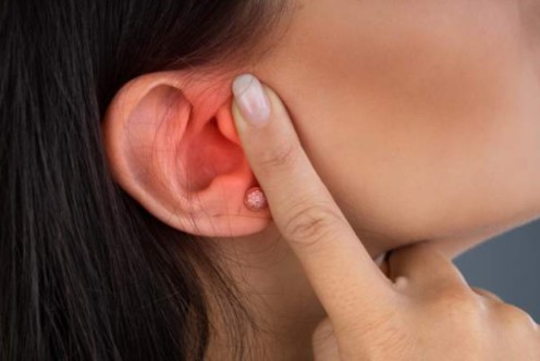 돌발성 난청으로 귀가 먹먹하고 통증을 느끼는 여성