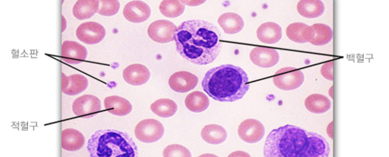 빈혈-혈액 세포의 구성