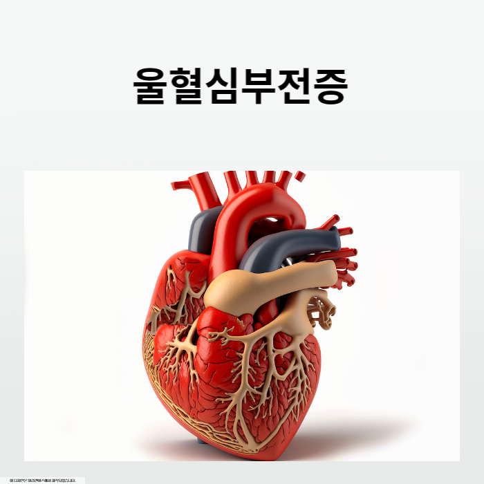 울혈심부전증