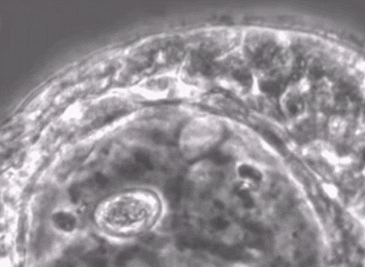  손상된 신경 조직 복구해주는 '앤트로봇' VIDEO: Anthrobots: Tiny Biobots From Human Cells Heal Neurons
