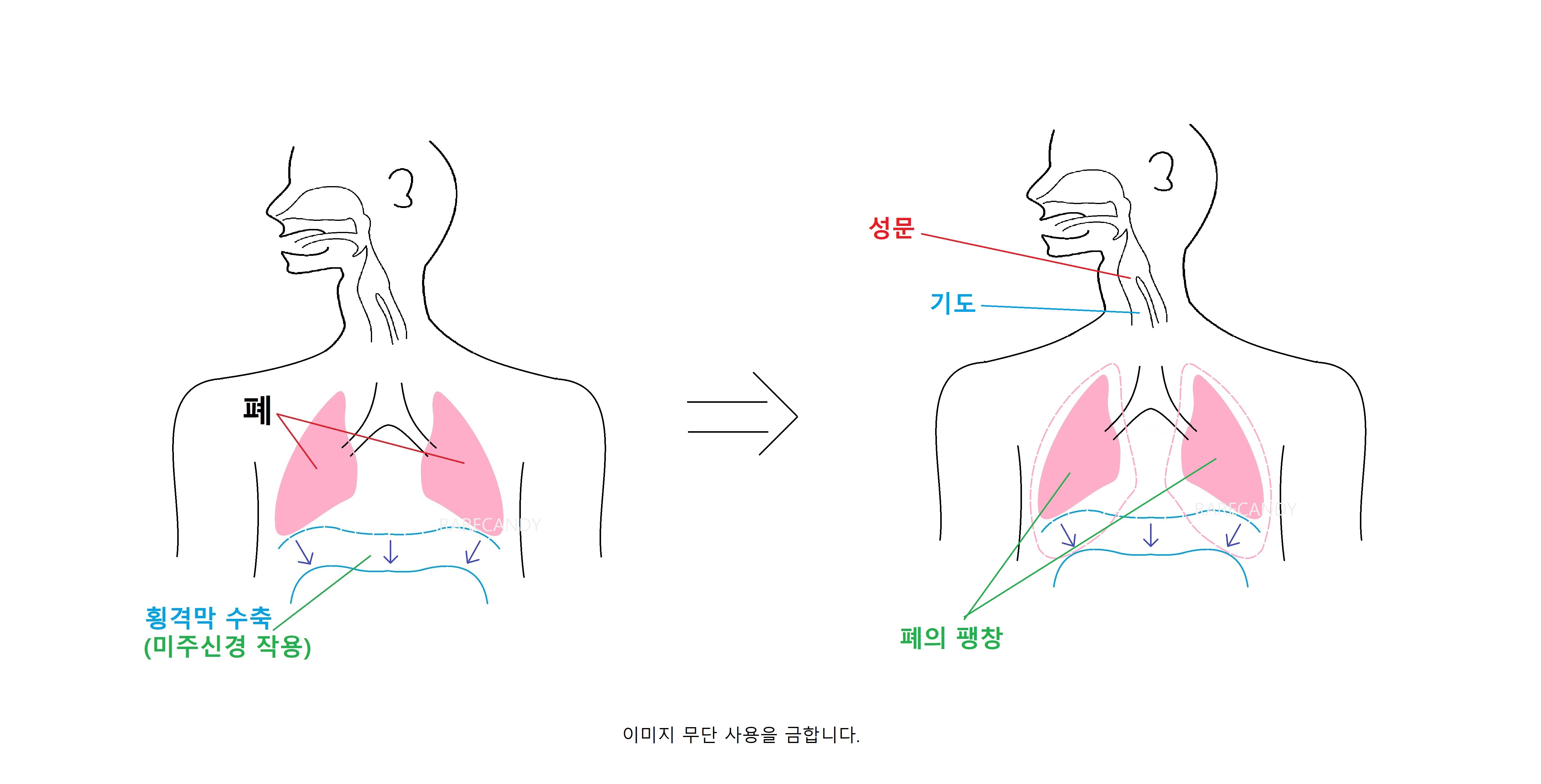 딸꾹질 나오는 과정 그림