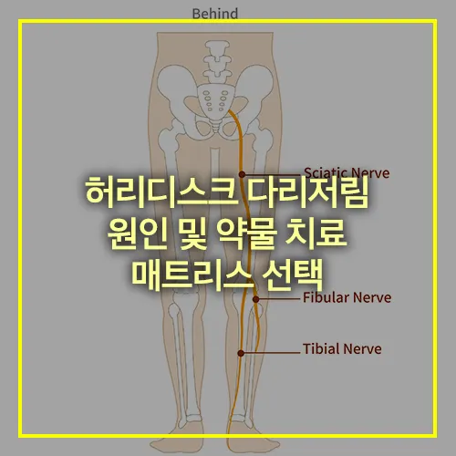 허리디스크 다리저림 원인