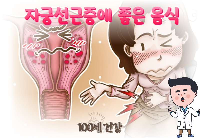  자궁선근증에 좋은 음식