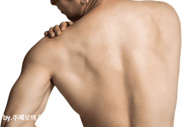 오십견 증상 어깨 관절의 열감과 통증