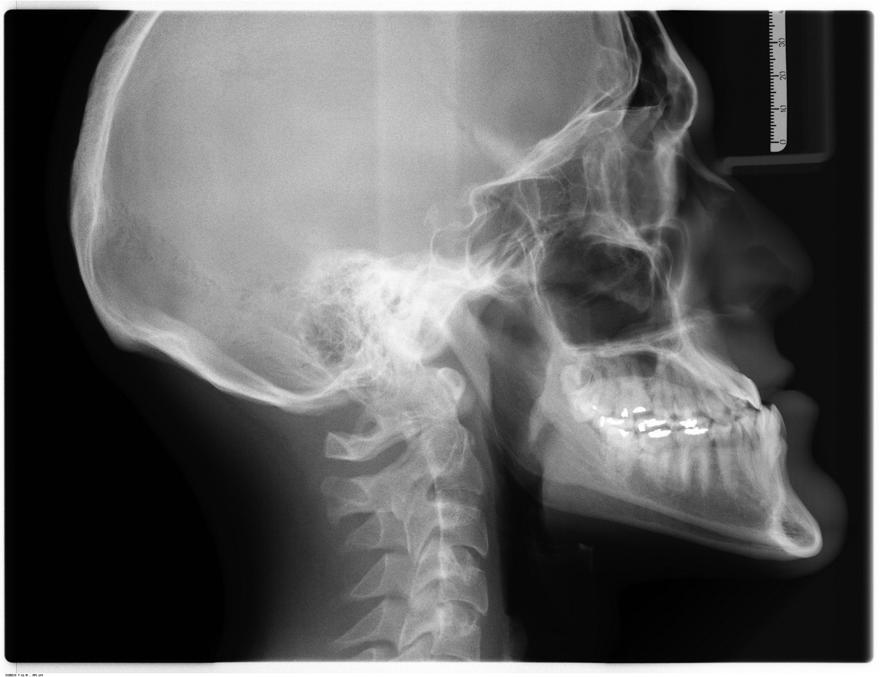 X-ray 카메라의 사용 원리와 과학적 응용 사례