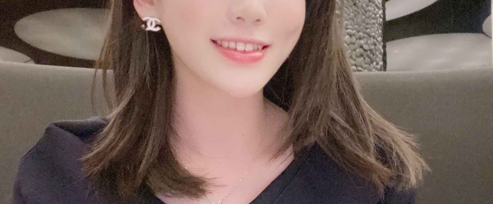  비포덴트 투명교정 솔직한 후기1 (장점, 후회할 수도 있는 점들...)
