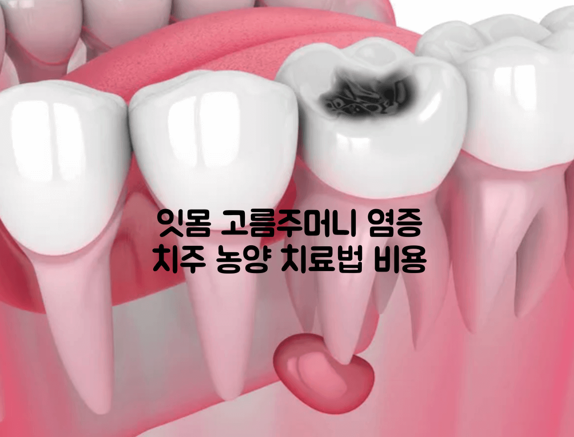 잇몸 고름주머니 염증 치주 농양 치료법 비용 잇몸 고름주머니 염증 치주 농양 치료법 비용