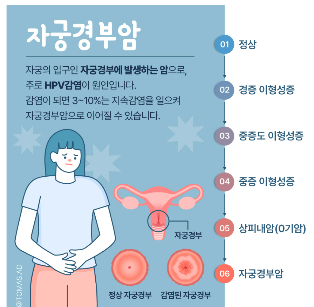 자궁경부암 예방접종 가격 자궁경부암 무료접종 대상