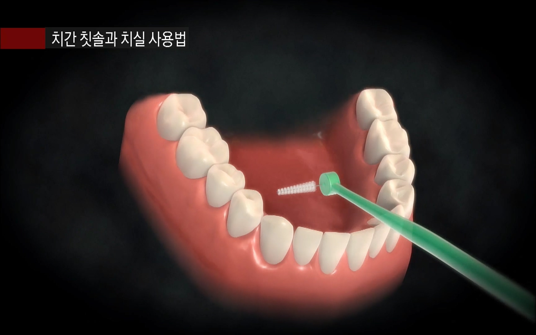 EBS 명의 헬스케어 - TV - 교육의 중심 EBS2015년 1월 16일 (금) 밤 9시 50분, EBS1.mp4_20220505_150409.712.jpg