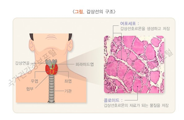 증상 하시모토 갑상선염이라고... 갑상선 기능 저하증의 원인과