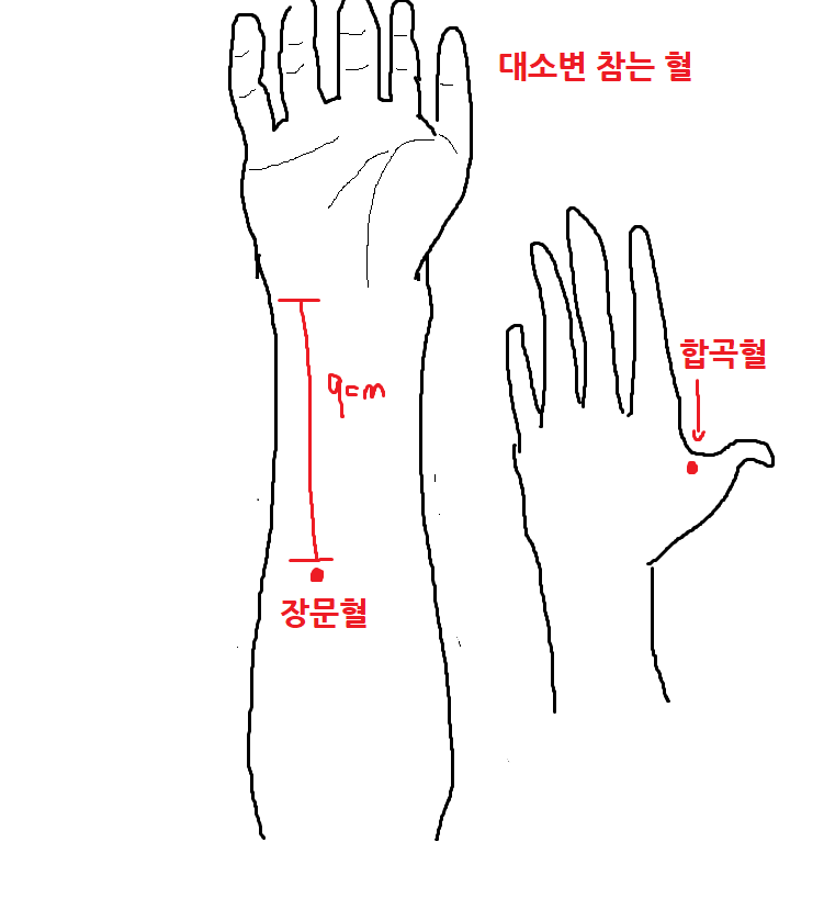 급똥 참는 법