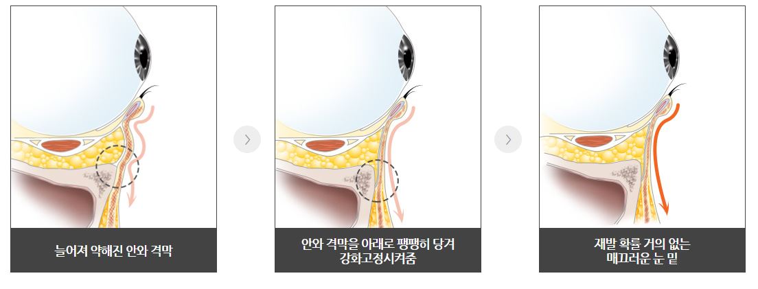 수술 과정 및 회복 상황