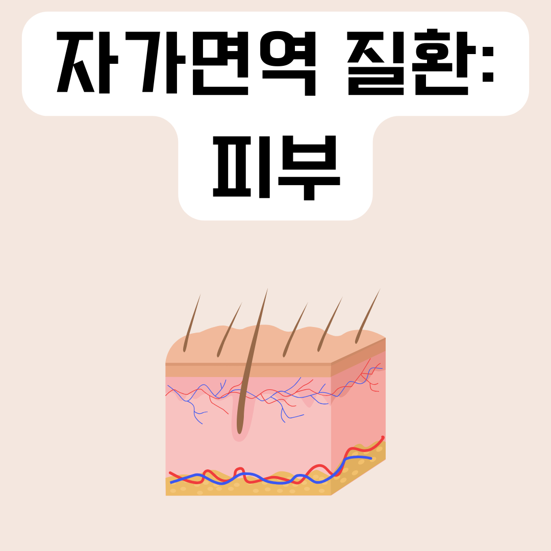 자가면역-질환-피부