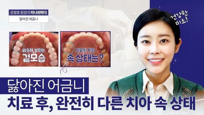 어금니 칫솔 사용법 선택방법 실사용 후기_9