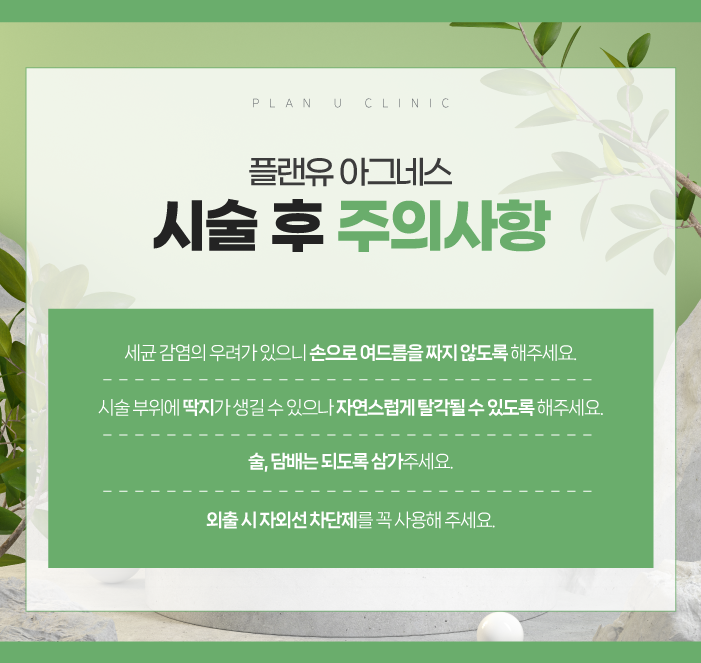 아그네스 이미지
