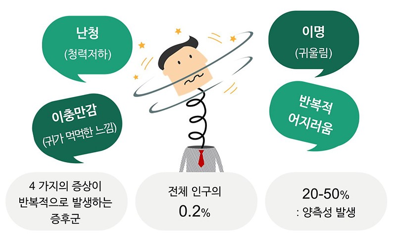 메니에르병 증상. 치료