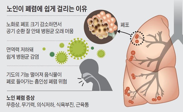  폐렴 초기 증상