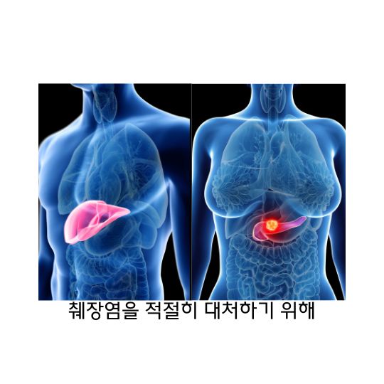  췌장염 원인, 증상, 예방 그리고 치료방