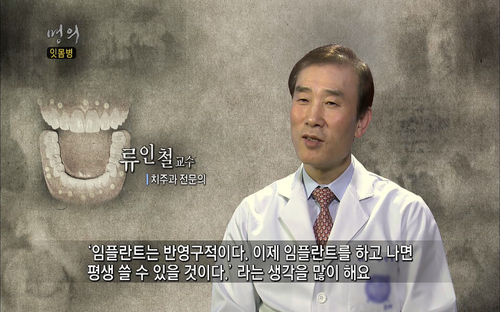 EBS 명의 헬스케어 - TV - 교육의 중심 EBS2015년 1월 16일 (금) 밤 9시 50분, EBS1.mp4_20220505_145746.845.jpg