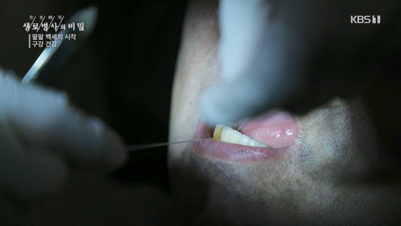 생로병사의 비밀.E894.240118p.H264-F1RST.mp4_20240118_195342.687.jpg