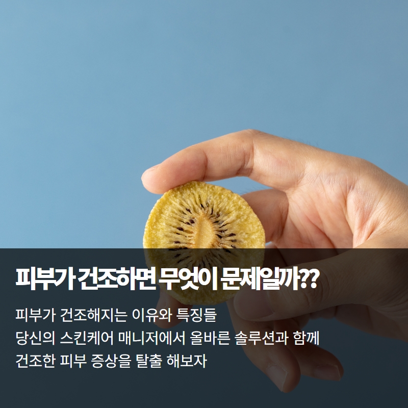  피부건조증상 올바른 스킨케어 관리로 예방을 하는방법