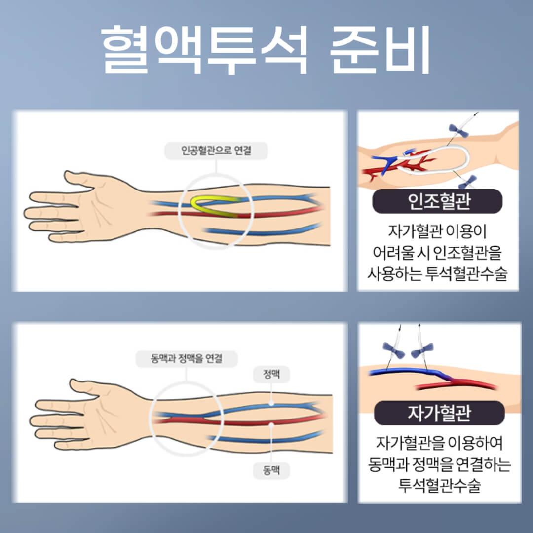 혈액투석 준비