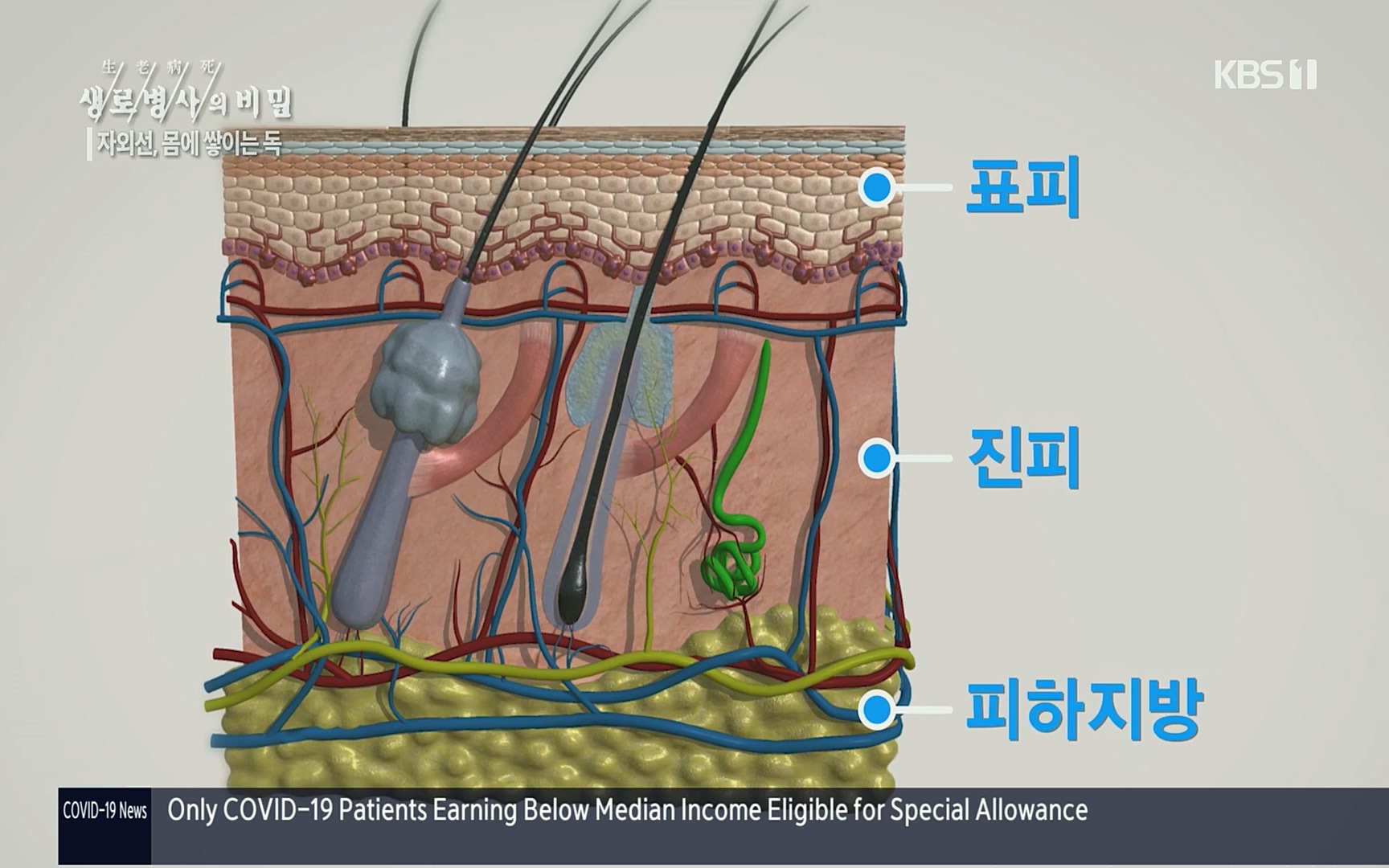 생로병사의 비밀.E824.220629p.H264-F1RST.mp4_20220630_205904.417.jpg