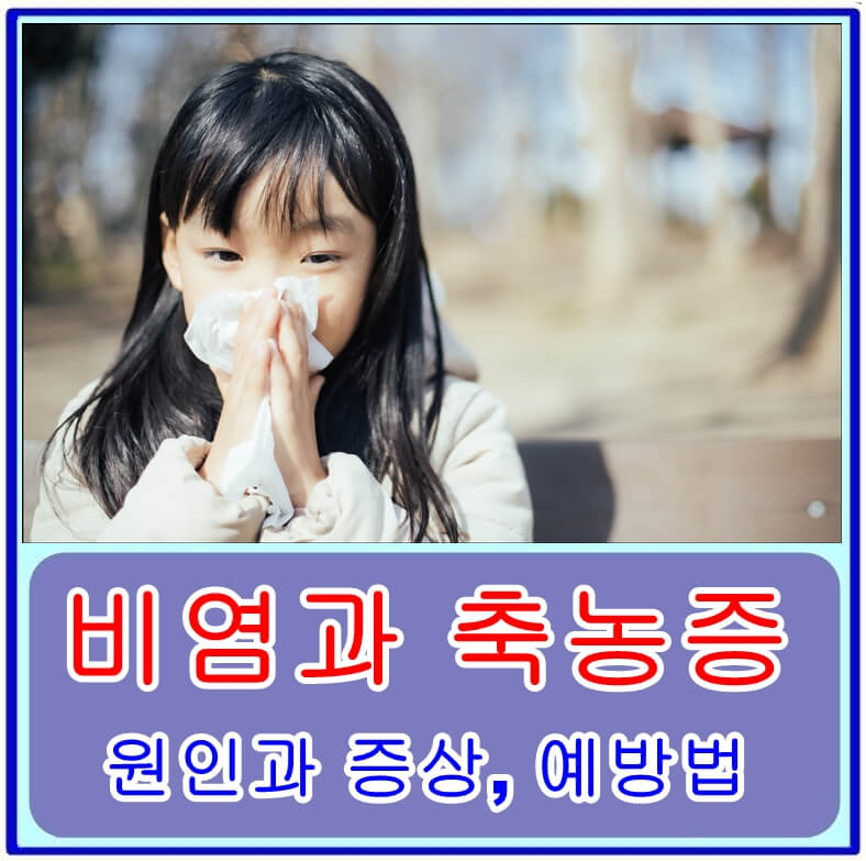  비염과 축농증, 같아 보여도 다른 질환! 원인과 증상, 예방법은?