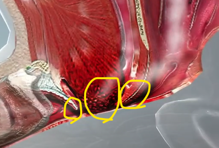 코골이가 발생하는 혀뿌리(1)&amp;#44; 편도(2)&amp;#44; 입천장(3)의 근육이 늘어지는 모습