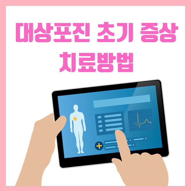  대상포진 초기증상 및 치료방법