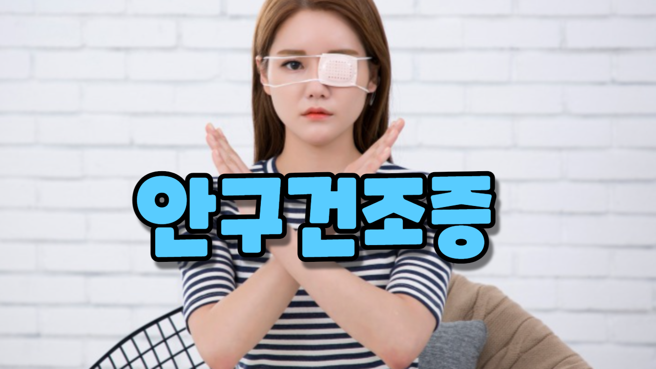  안구건조증