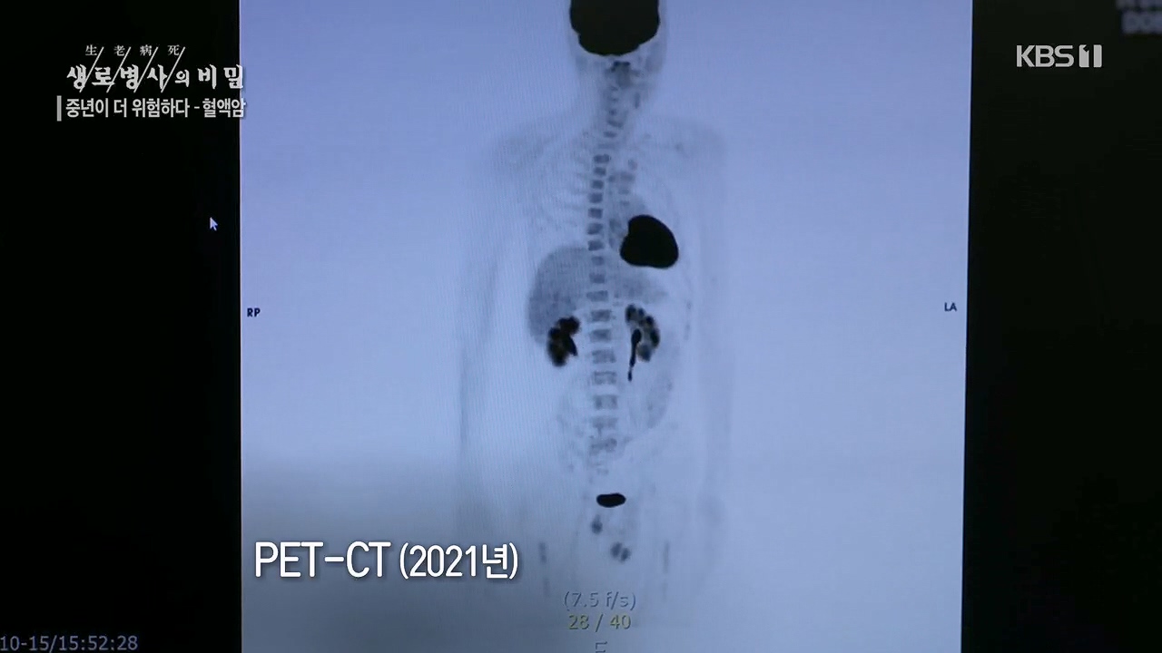 생로병사의 비밀.E868.230511p.H264-F1RST.mp4_20230511_201442.058.jpg