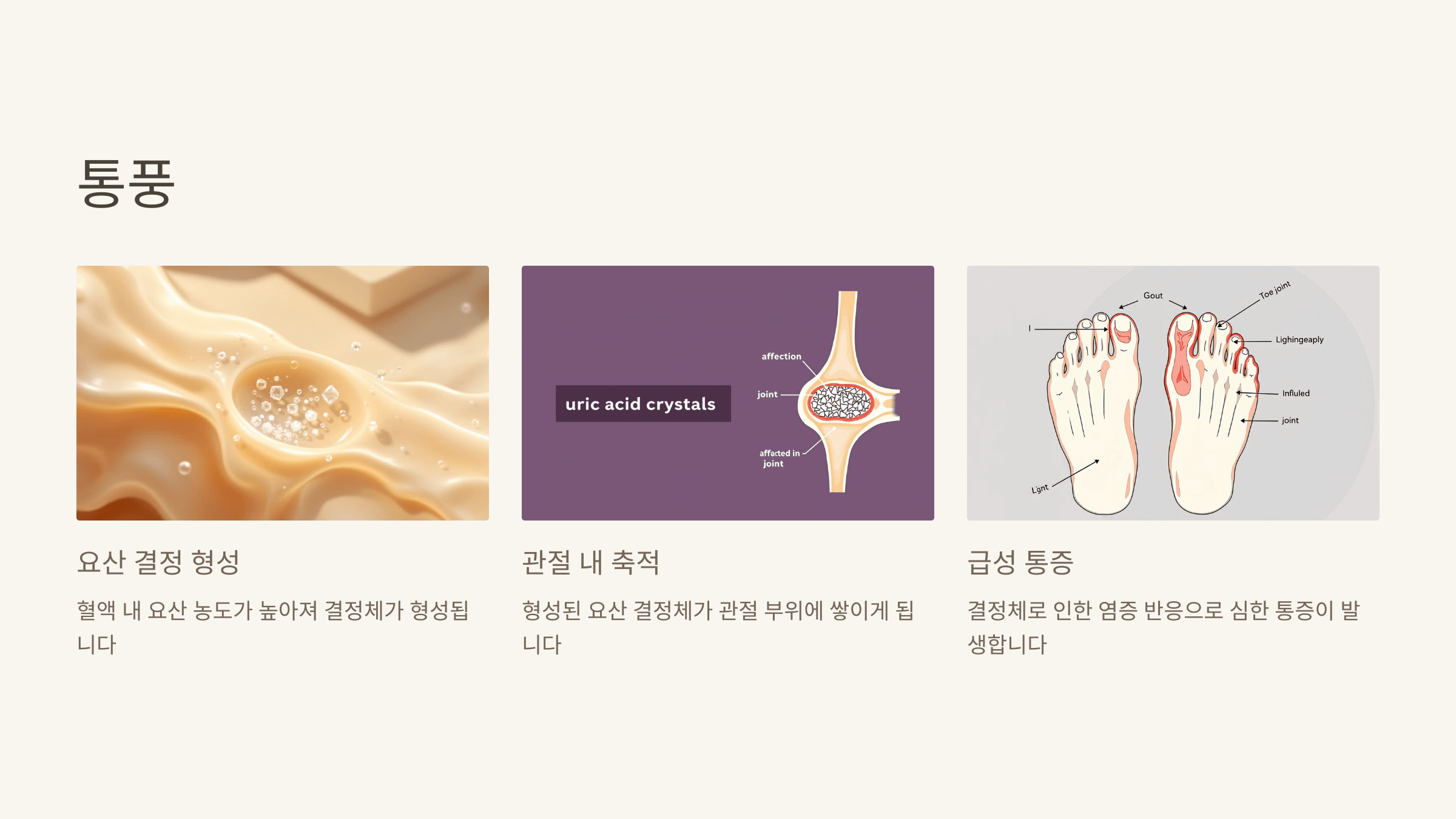 손가락 마디 통증과 관련된 사진입니다.